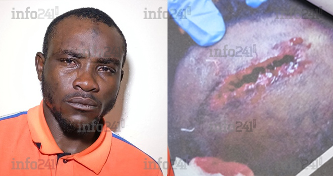 Un gabonais de 27 ans écroué après avoir ouvert au tonfa le crane d’un jeune qui injuriait ses proches